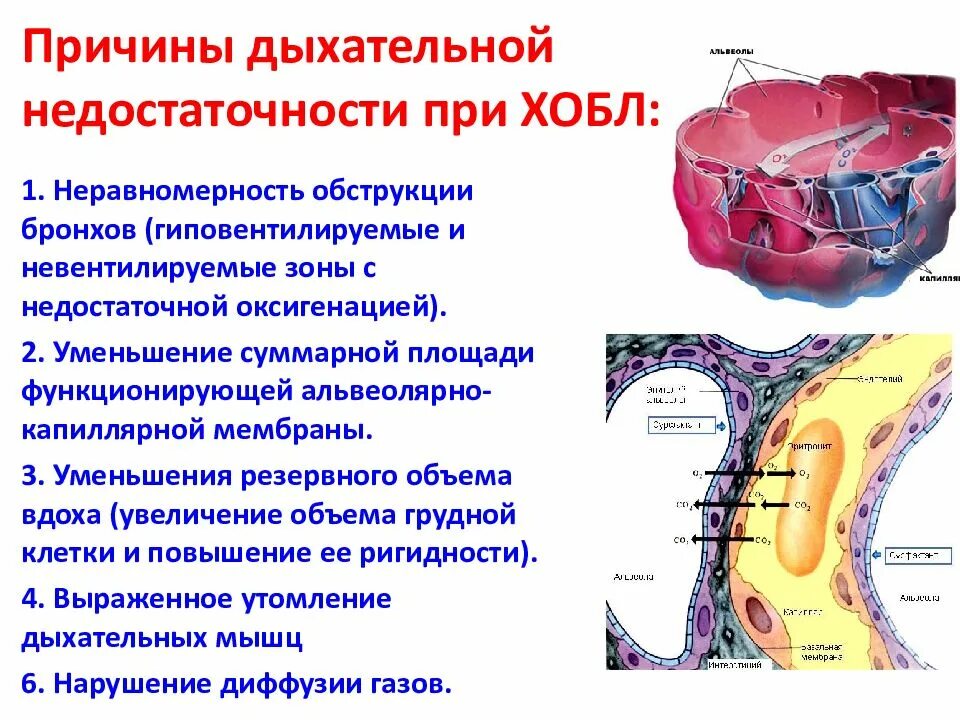 При хронических обструктивных заболеваниях легких осложнения. Дыхательная недостаточность при бронхите. Дыхательная недостаточность при бронхите. Тип дыхания при дыхательной недостаточности. При хронических обструктивных заболеваниях легких осложнения.
