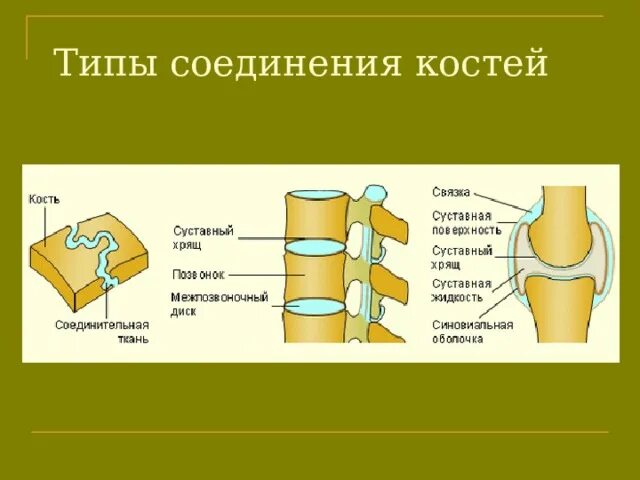 Перечислите соединение костей. Типы соединения костей. Типы соединения костей человека. Типы соединения костей животных. Виды соединения костей схема.