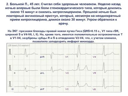 Что означает умеренное изменение миокарда