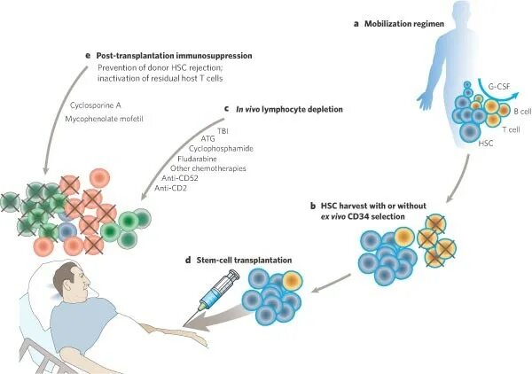 Терапия стволовыми клетками при рассеянном склерозе. Рассеянный склероз (рс) -. Иммунный склероз. Трансплантация стволовых клеток при рассеянном склерозе. Мезенхимальная стволовая клетка источник.