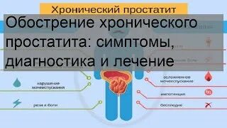 Виды простатита. Хронический простатит клиника. Обострение простатита симптомы. Мастурбация при обострении простатита.