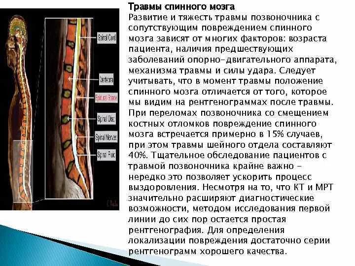 Спинальная нестабильность что это. Повреждение спинного мозга последствия. Травма позвоночника с повреждением спинного мозга. Травматическое поражение спинного мозга. Поражение спинного мозга мрт.