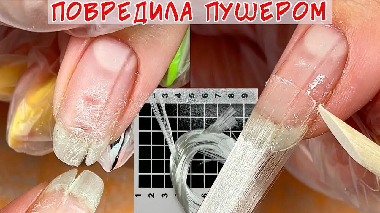 Отодвигание кутикулы апельсиновой палочкой. Повреждение матрикса ногтя. Строение ногтя матрикс корень ногтя. Ноготь после повреждения матрикса. Повреждение матрицы ногтя.