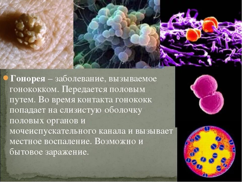 Заражение крови половым путем. Половая инфекция гонорея.