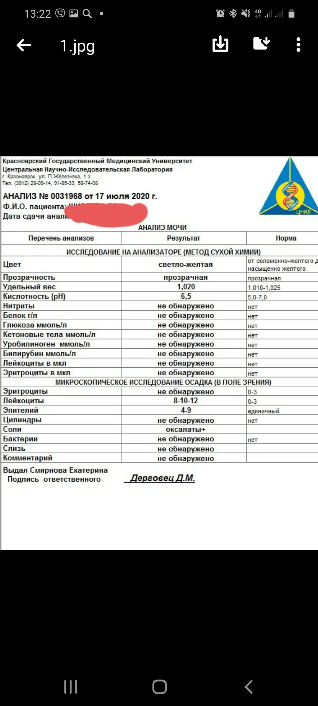 Сильно повышены лейкоциты в моче. Анализ мочи лейкоциты. Лейкоциты в моче повышены. Анализ мочи лейкоциты повышены. Повышение лейкоцитов в моче.