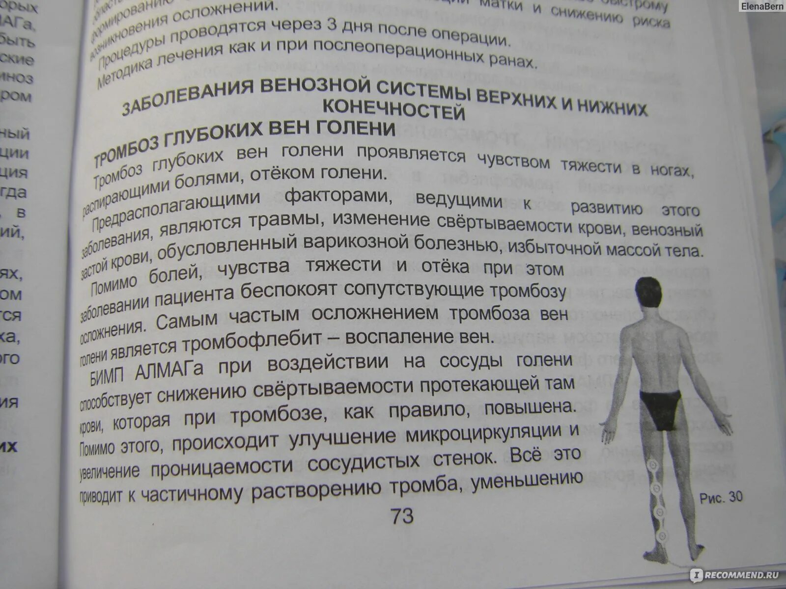 Алмаг колено как правильно. Инструкция по алмаг 01. Показания к применению аппарата алмаг-1. Алмаг-01 инструкция. Алмаг-01 инструкция на колено.