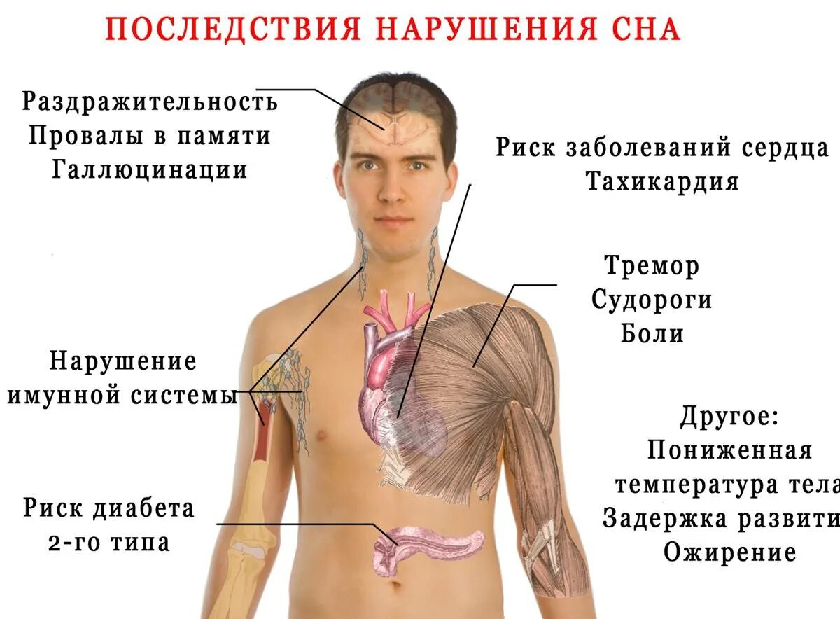 Как называется синдром порядка