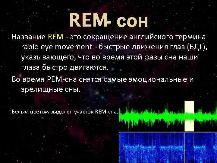 Rem фаза сна. Фазы сна Rem сон. Rem быстрый сон. Rem, NREM фазы сна Rem.