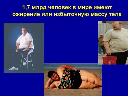 Что ведет к ожирению