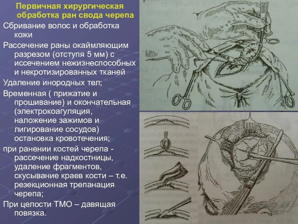 Хирургический латынь. Первичная хирургическая обработка непроникающих РАН свода головы. Первичная хирургическая обработка непроникающих РАН свода черепа. Пхо Оперативная хирургия. Пхо проникающих и непроникающих РАН свода черепа.