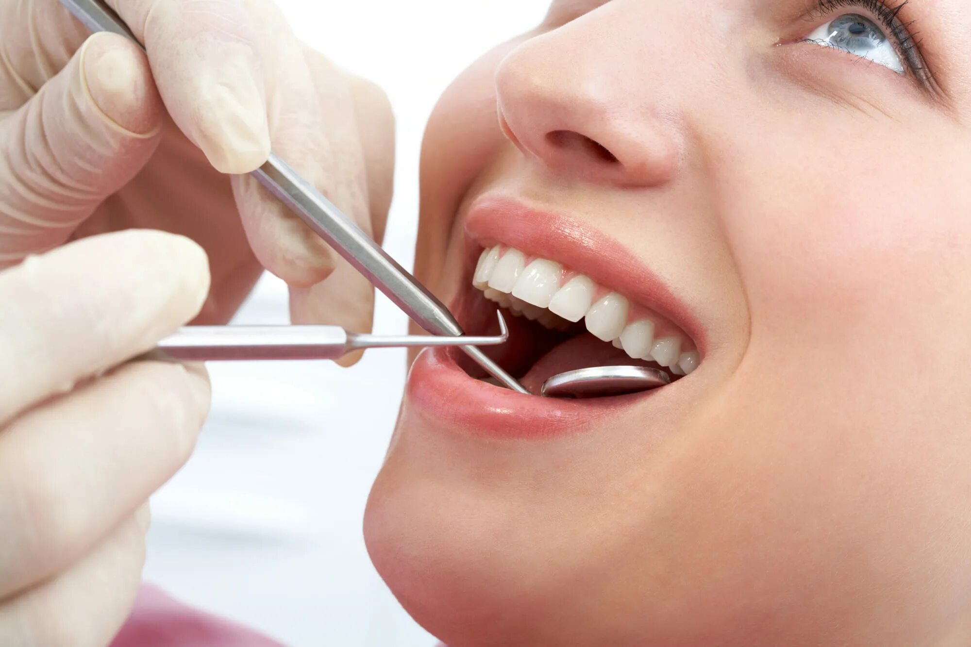 Tooth filling