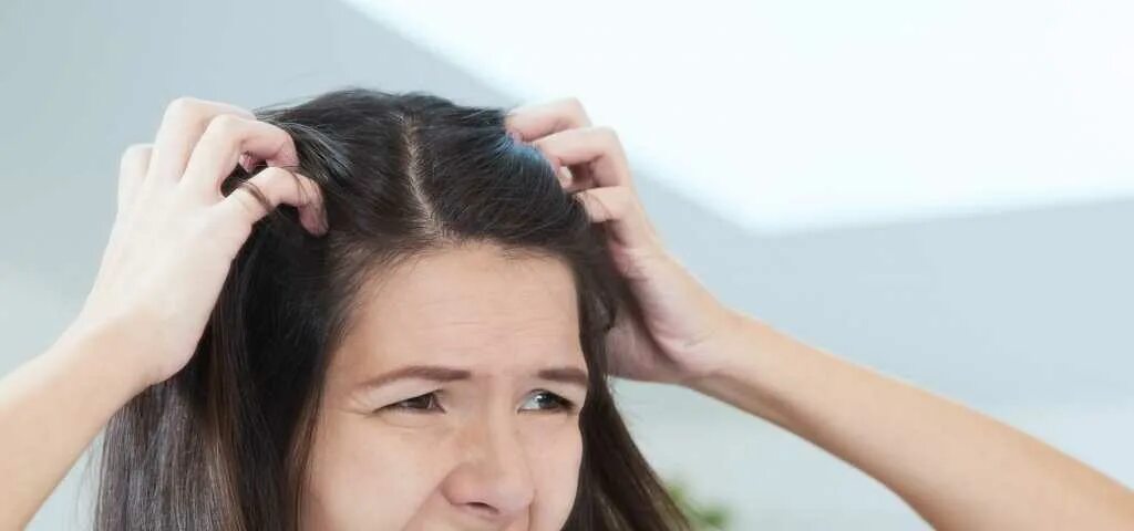 Зуд головы и выпадение волос причины. Аллергия на шампунь на голове.