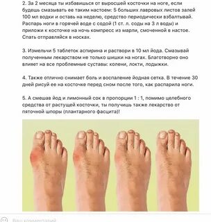 Избавиться от косточки на ноге отзывы