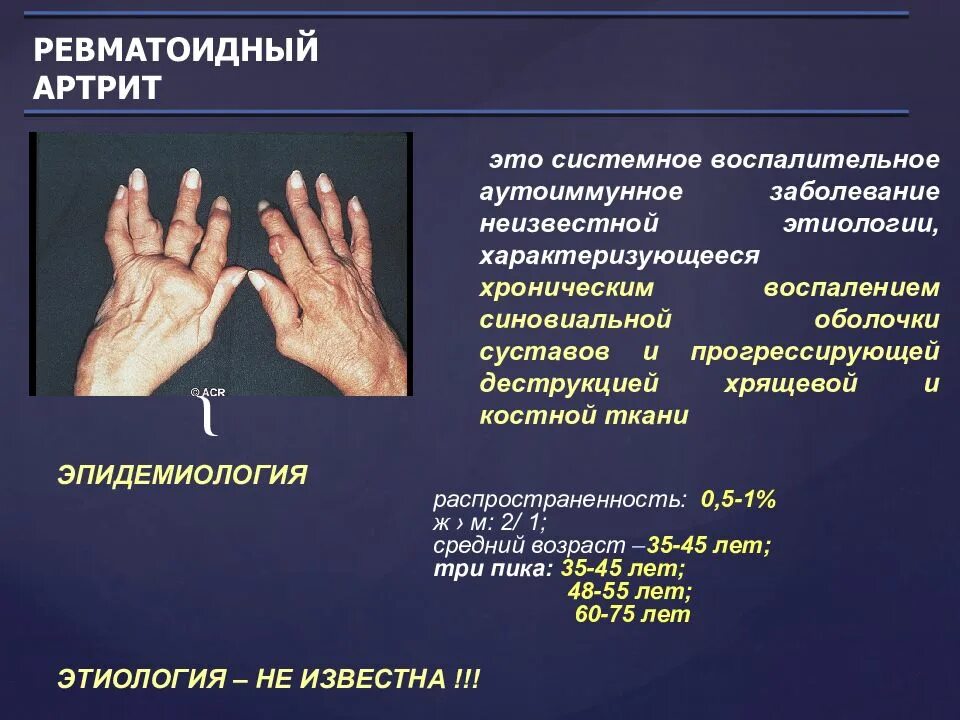 Ревматоидный артрит мышцы. Ревматоидный артрит поражение суставов. Симптомы поражения суставов ревматоидного артрита. Паллиативный ревматоидный артрит. Хронический ревматоидный артрит диагноз.