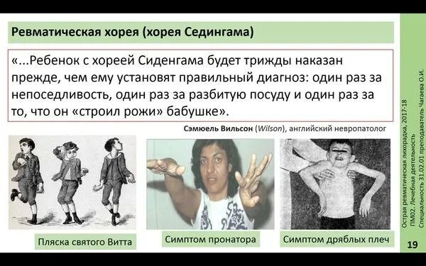 Болезнь пляска святого. Ревматизм симптомы малая Хорея. Хорея Гентингтона пляска Святого Витта. Хорея Сиденгама синдромы. Малая Хорея при острой ревматической лихорадке.