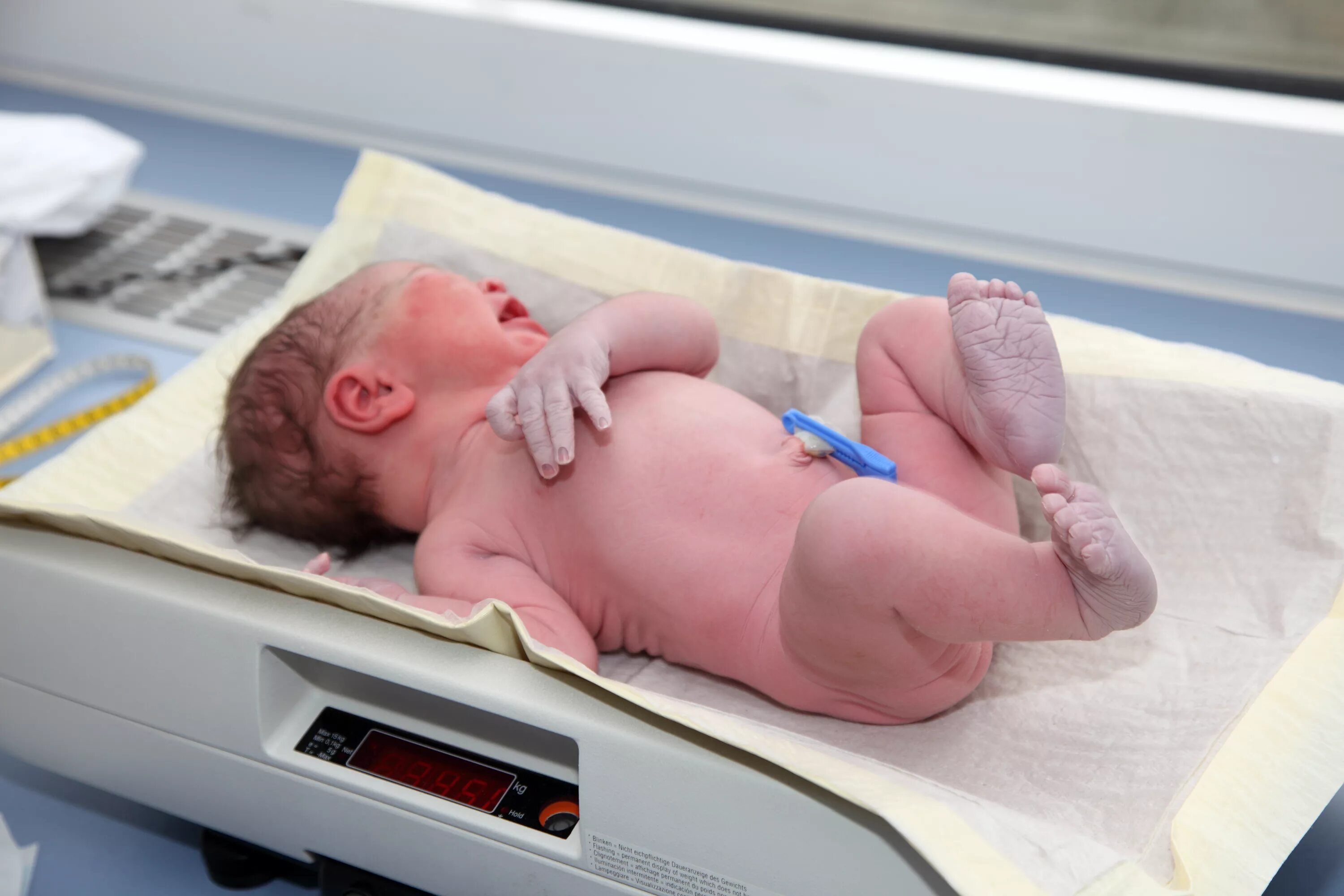 Недавно родившийся ребенок. Тетрада Фалло у новорожденных. Новорожденный ребенок. Новорожденный только родился.