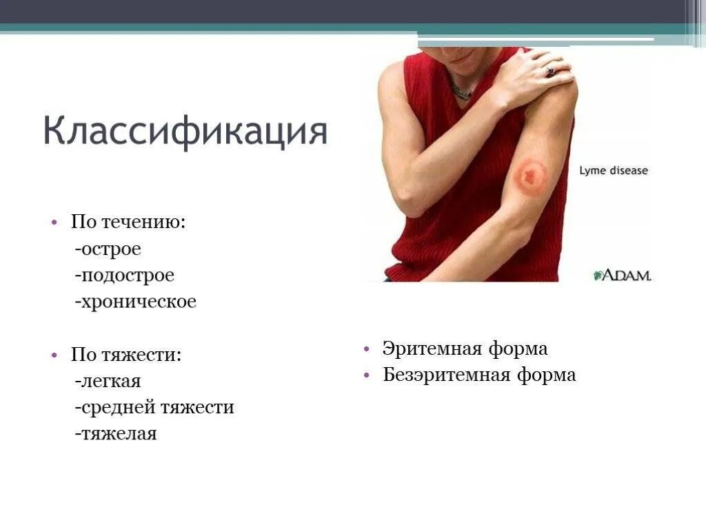 Клещевой боррелиоз иммунитет. Берлиоз симптомы у ребенка. Боррелиоз клинические синдромы. Берлиоз болезнь признаки. Берлиоз болезнь признаки.