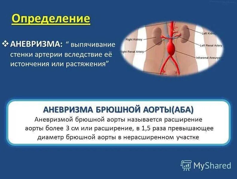 Как лечить брюшную аорту