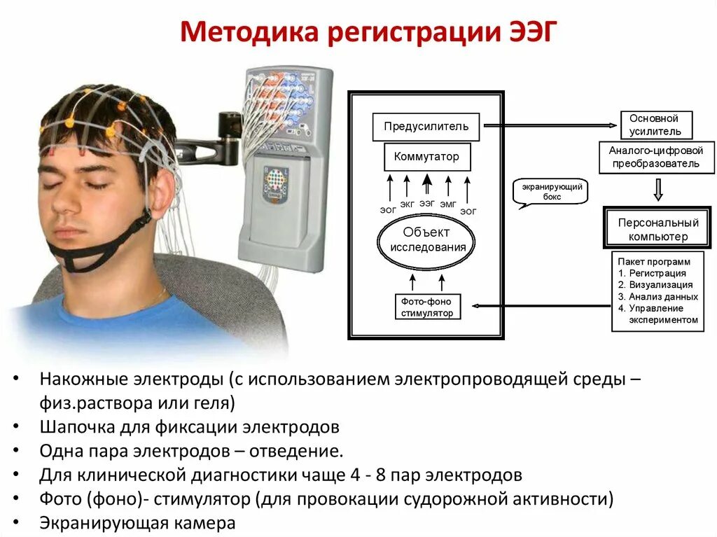 ЭЭГ методика проведения. ЭЭГ головного мозга методика проведения. Методика регистрации ЭЭГ. Электроэнцефалография методика проведения. Нарушения биоэлектрической активности мозга