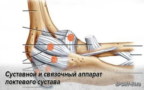 Растяжение капсульно связочного аппарата