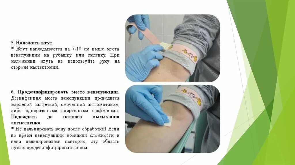 Жгут на вену. Наложение жгута при внутривенной инъекции. Жгут для внутривенных инъекций резиновый. Наложение жгута при венозном кровотечении. Техника наложения жгута для внутривенной инъекции.