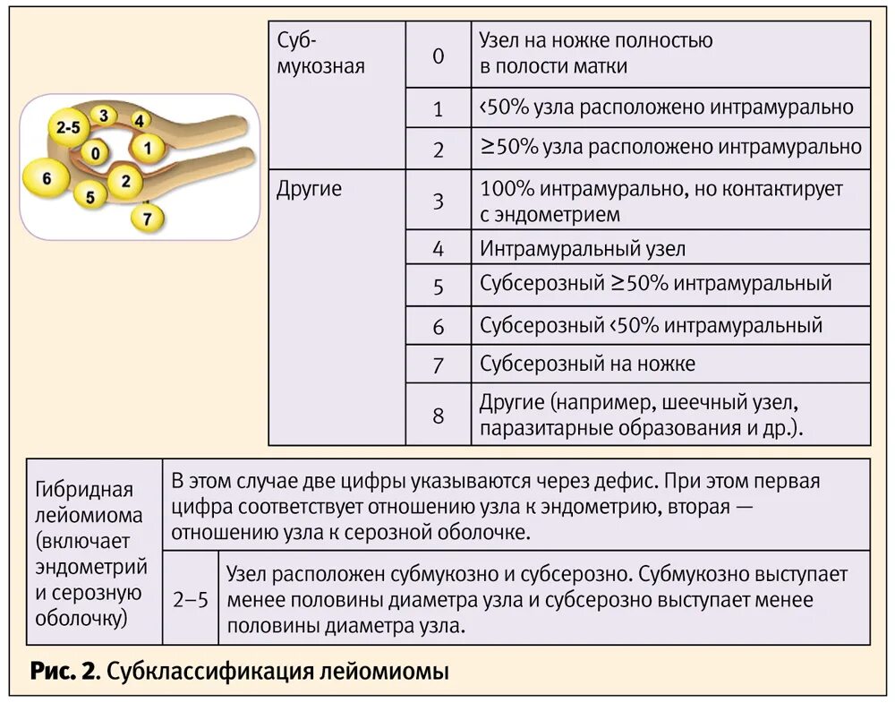 Картинки АНАМНЕЗ МИОМЫ МАТКИ