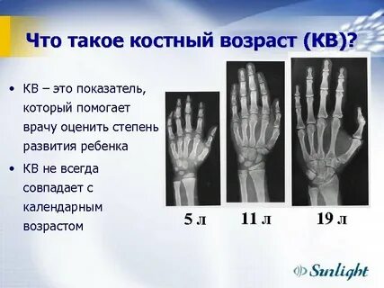 Таблица костного возраста ребенка