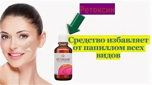 Удаление папиллом по полису омс