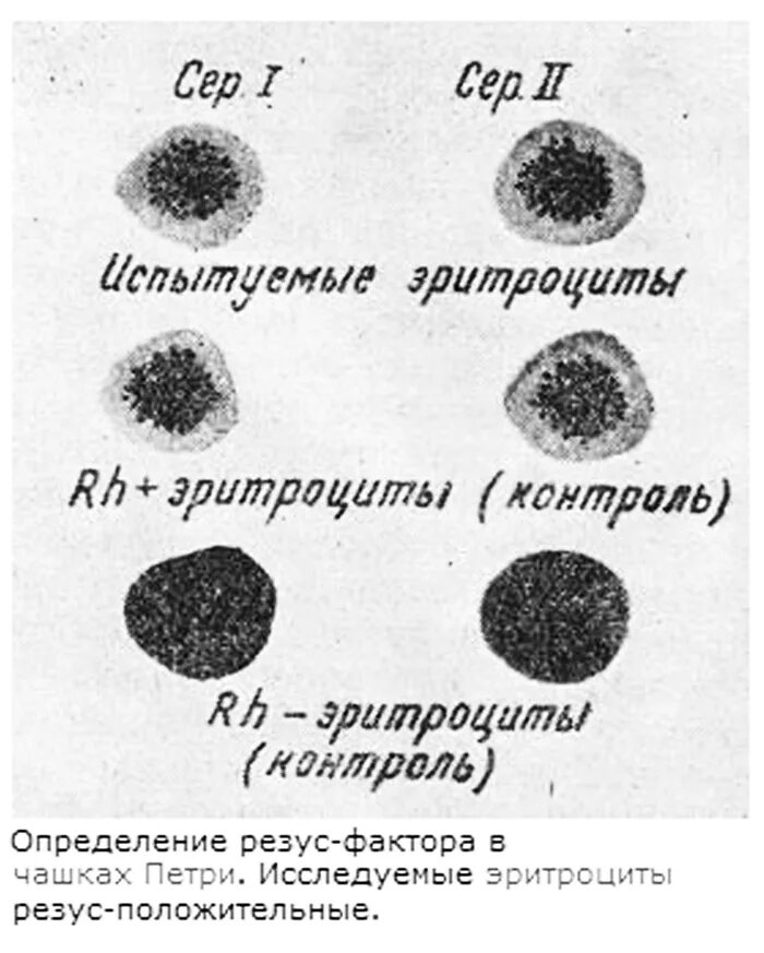 Определение резус фактора в чашке Петри. Определение резус фактора. Определение Резуса. Определение резус фактора алгоритм. Резус фактор экспресс методом