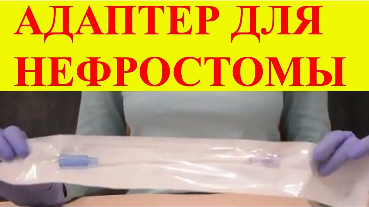 Нефростома не идет моча