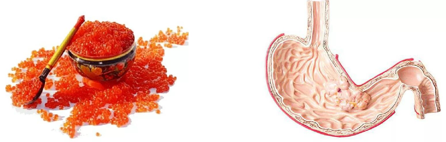 Икра для диабетиков. Икра для диабетиков. Красная икра. Красная икра. Wild salmon икра горбуши.