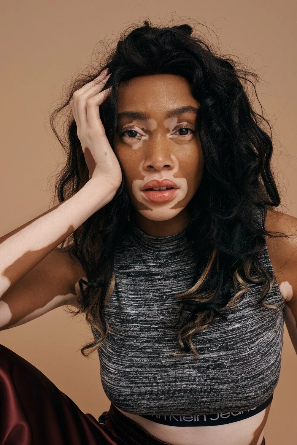 Winnie Harlow. Винни Харлоу фотосессии. Винни Харлоу фотомодели Канады. Винни Харлоу топ-модель по американски. Нестандартное лицо