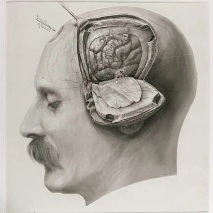 Brain old. Трепанация черепа анатомичка. Вскрытие черепа человека. Человеческий мозг в черепе.