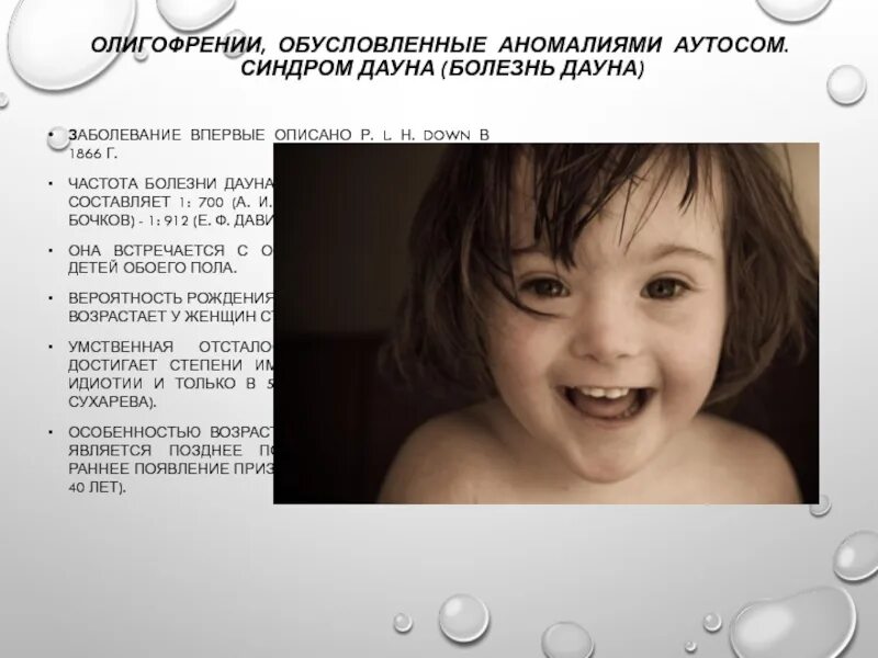 Синдром дауна встречается. Синдром дауна, умственная отсталость, олигофрения. синдромы с числовыми аномалиями аутосом. синдром дауна и олигофрении. синдром дауна обусловлен.