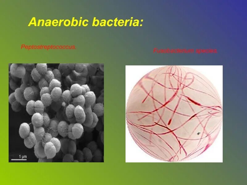 Пептострептококки фузобактерии. Анаэробные пептострептококки. Пептострептококки патогенез. Anaerobic bacteria.