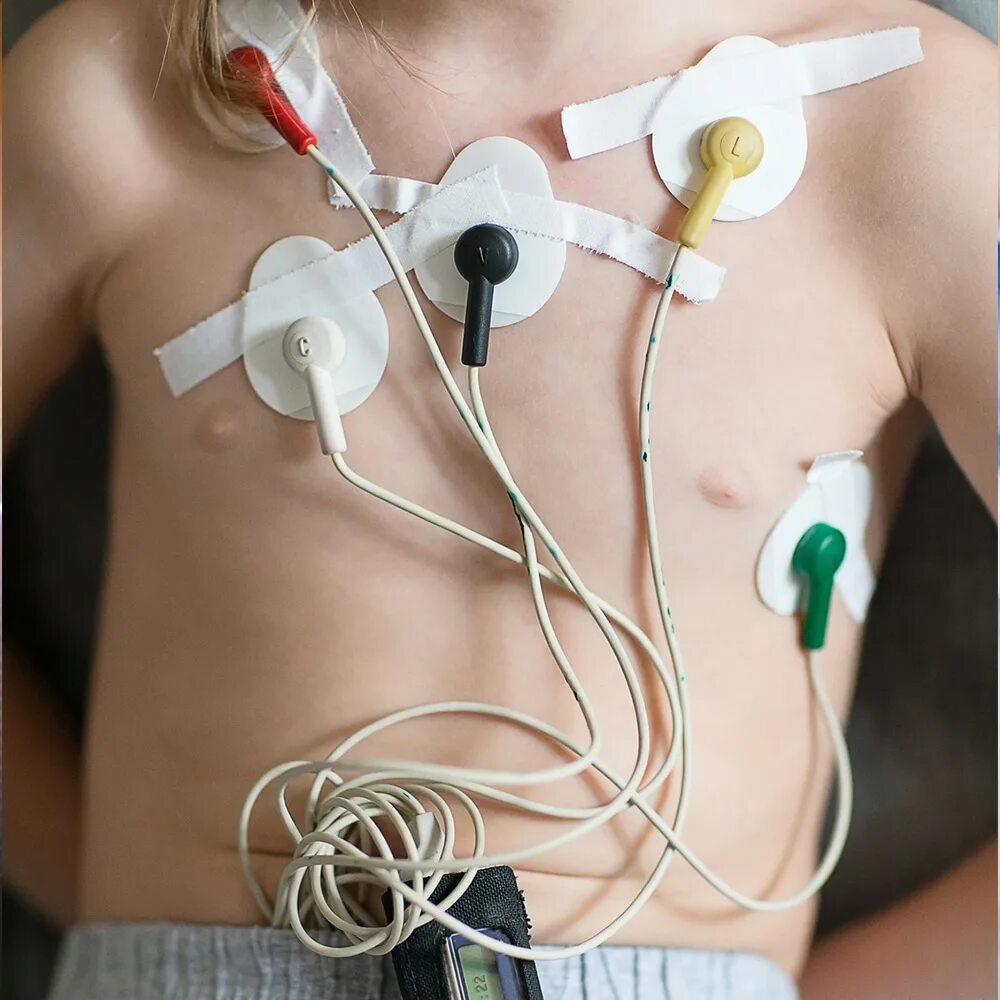 холтер ребенку. холтер детям. холтер детям. холтеровское мониторирование у детей. холтер мониторирование у детей.