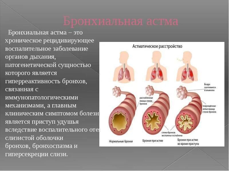 Первичный бронхит. Бронхиальная астма. Бронхиальная астма бронхи. Бронхиальная астма это заболевание. Бронхи при бронхиальной астме.