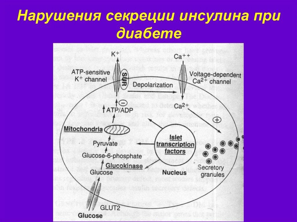 Нарушение выработки инсулина