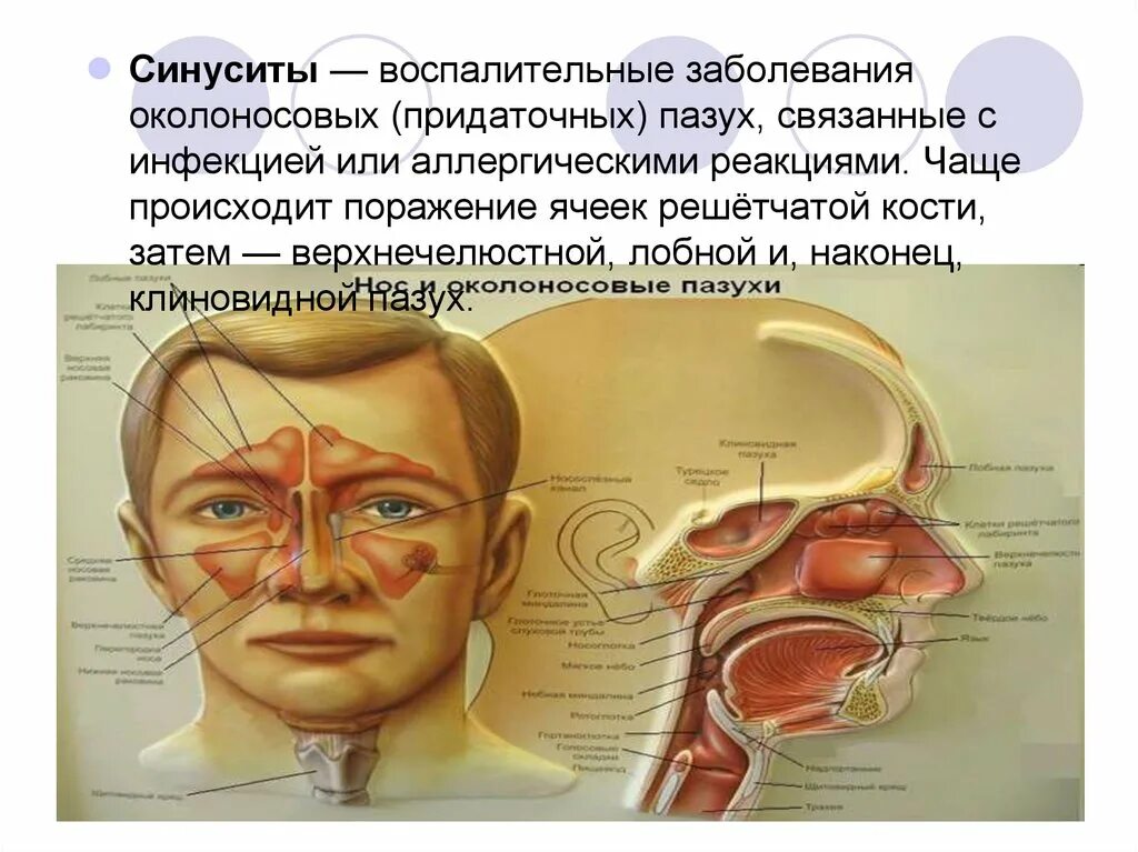 Инфекции лор органов. Заболевания оклоносныхпазух. Заболевания околоносовых пазух. Околоносовые пазухи носа.