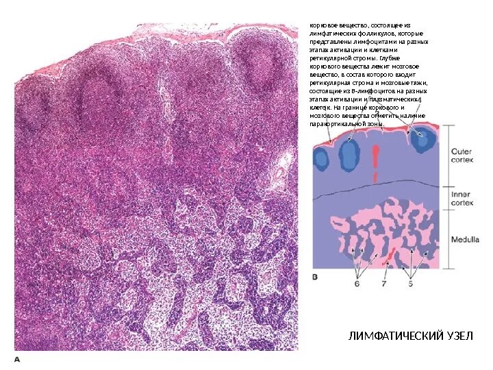 Лимфатич узел гистология. Лимфатический узел гистология препарат. Лимфоузлы гистология препарат. Корковое и мозговое вещество лимфатического узла. Реактивная гиперплазия лимфоузла