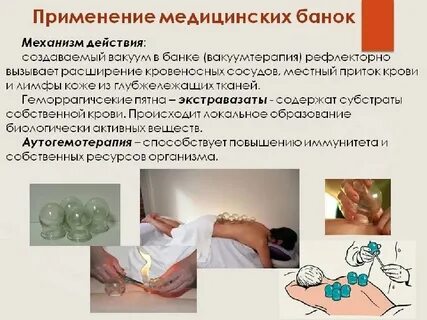 Банки для чего они нужны