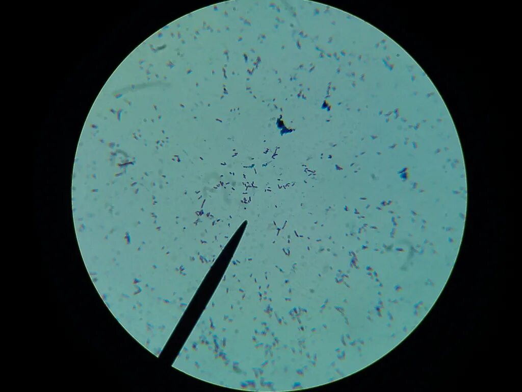 Иглы в моче. Виды микроскопов. Бактерии в микроскопе. Микроорганизмы в микроскопе. Снимок из микроскопа.