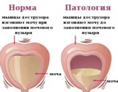 Ноющие после мочеиспускания