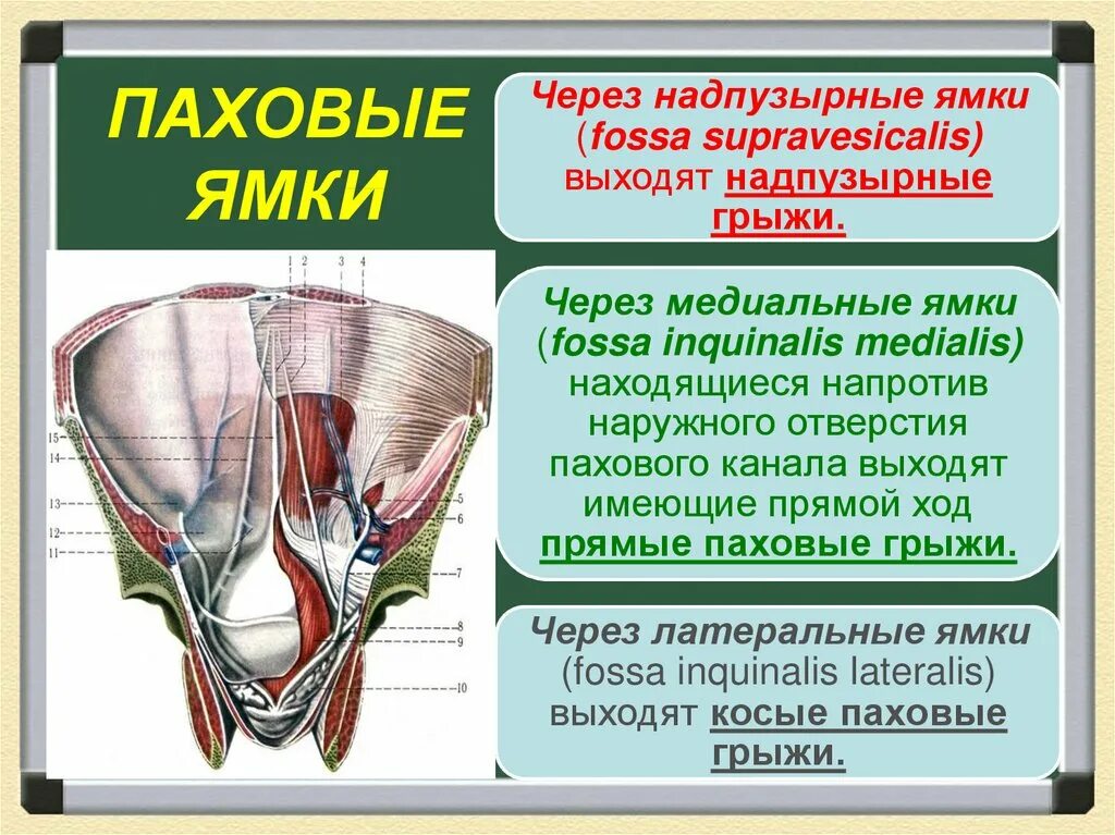 Паховая складка у мужчин. Медиальная ямка пахового канала. Латеральная паховая я ка. Латеральная паховая сумка. Латеральные паховые ямки.