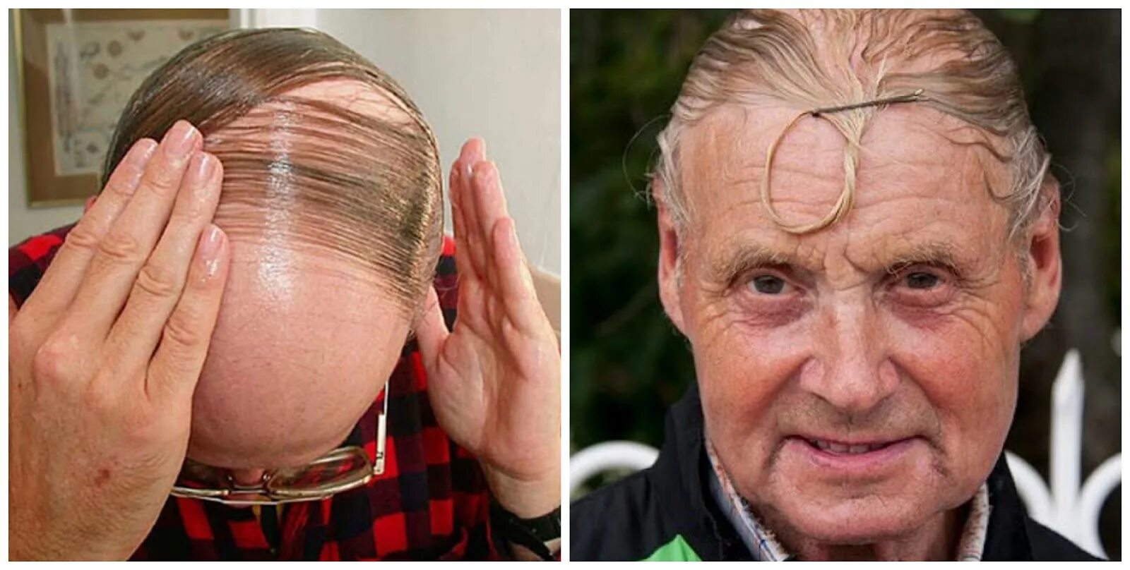 Как скрыть лысину. Лысые прически. Мужские прически для лысеющих. Как скрыть лысину. Прическа зачес на лысину.