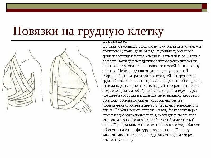 Повязка дезо как делать. Десмургия повязки на грудную клетку. техника наложения повязок на грудную клетку «дезо», молочную железу.. поддерживающая на молочную железу бинтовая повязка.