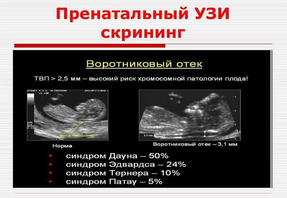 Воротниковое пространство норма