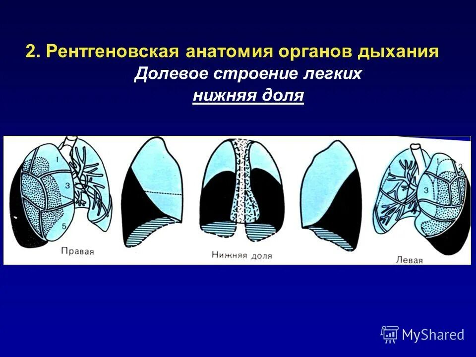 Ячеистое строение легких у пресмыкающихся. Эволюция дыхательной системы хордовых. Ячеистое строение легких. Ячеистое строение легких. Ячеистое строение легких.