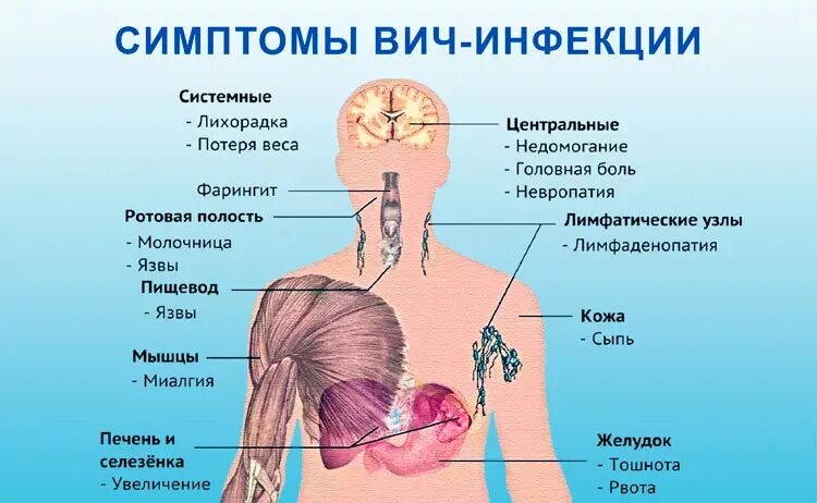 Основные симптомы ВИЧ инфекции.