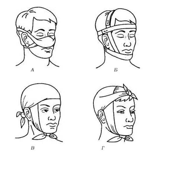 Нос затылок. Наложение пращевидной повязки. Пращевидная повязка на нос и затылок. Пращевидная перевязка. Бинтовая пращевидная повязка.